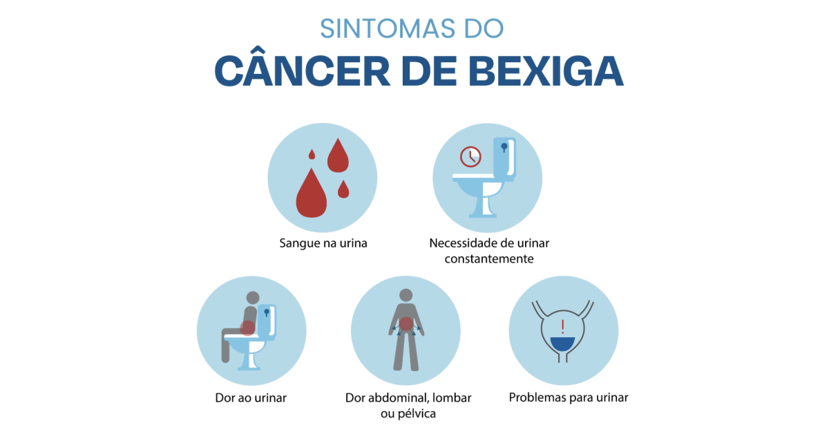 Sintomas de Cancer na Bexiga